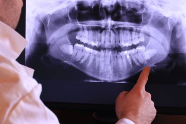 Best Emergency TMJ Treatment in Homewood, IL