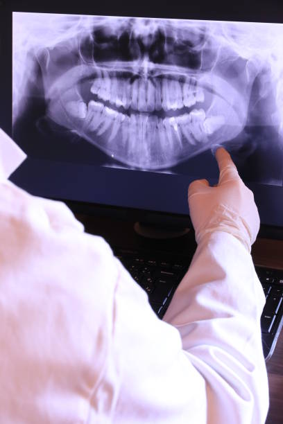 Best Emergency Dental Care for Broken or Chipped Teeth in Homewood, IL
